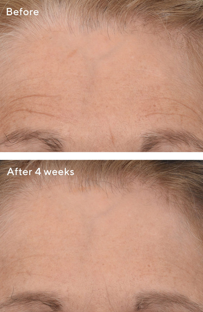 MURAD The Retinal ReSculptors-value set