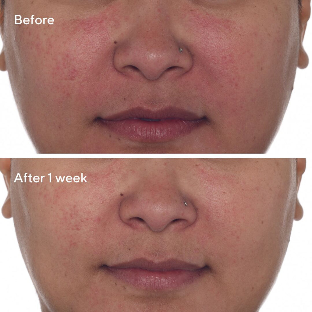 Murad Cellular Hydration Repair Oil Drops