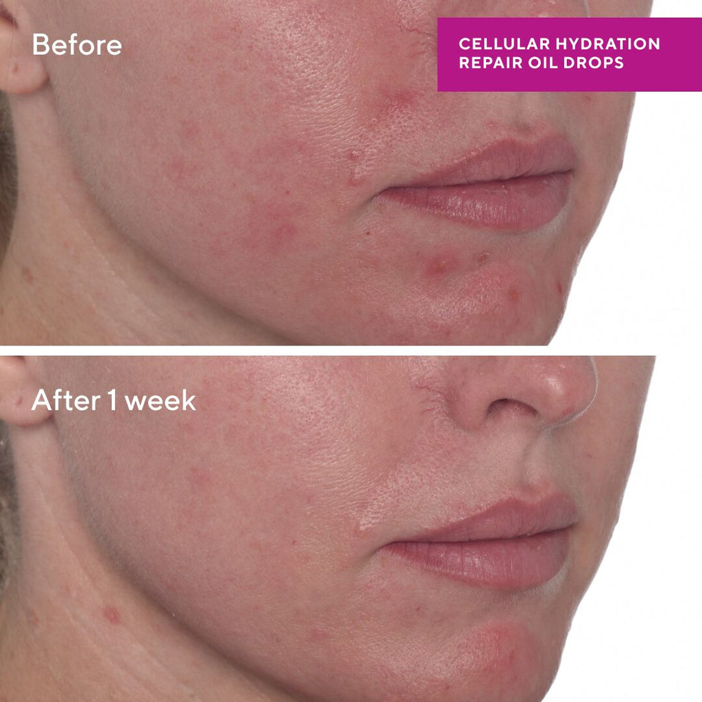 Murad Cellular Hydration Repair Oil Drops