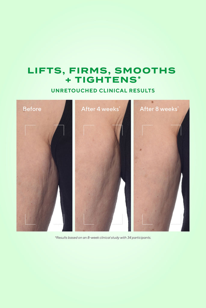 MURAD ReSculpt Body Treatment